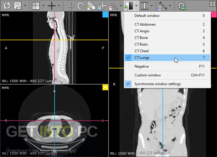 RadiAnt DICOM Viewer 2021 Free Download RadiAnt DICOM Viewer 2021 Free Download