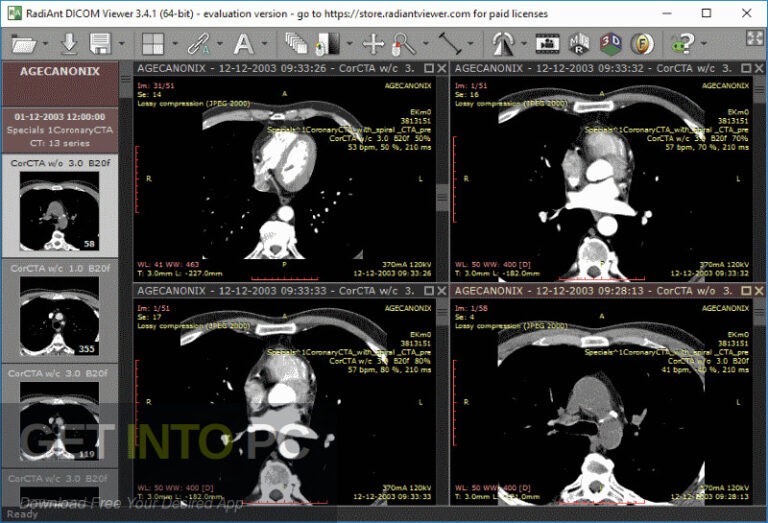 RadiAnt DICOM Viewer 2021 Free Download RadiAnt DICOM Viewer 2021 Free Download